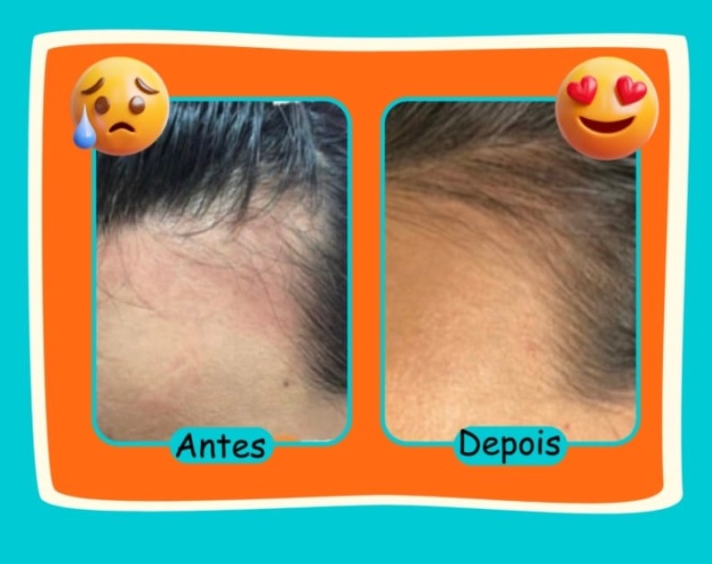 Resultado Polivitamínico