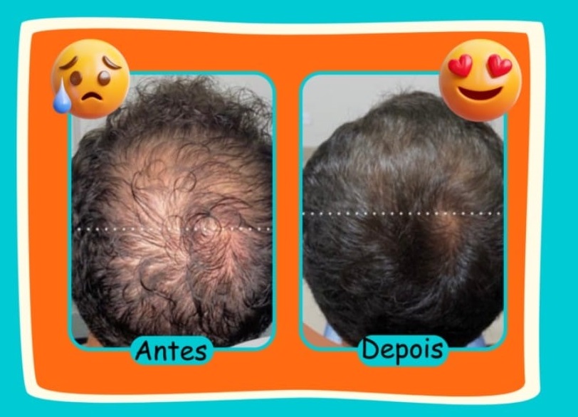 Resultado Polivitamínico